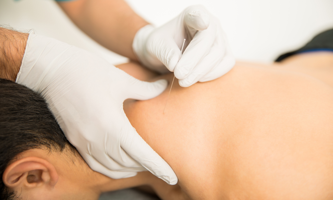 Medical Acupuncture Training